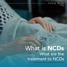 what is ncds