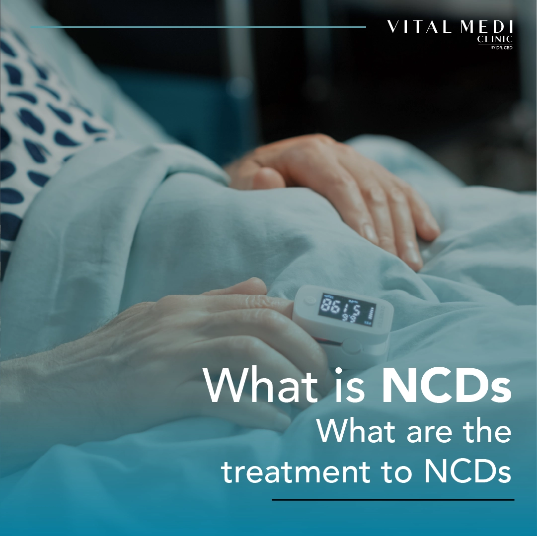 what is ncds